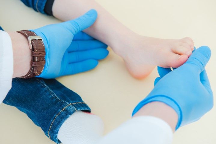 fascitis plantar pie niño